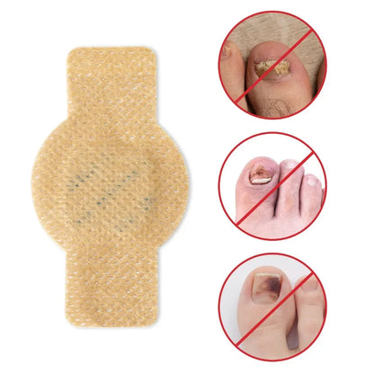 #1 Fungal Nail Patches (21 PCS)