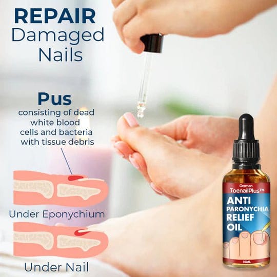 German ToenailPlus™ Anti-Paronychia Relief Oil