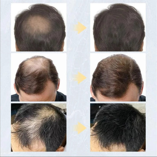 Polvo para el cabello