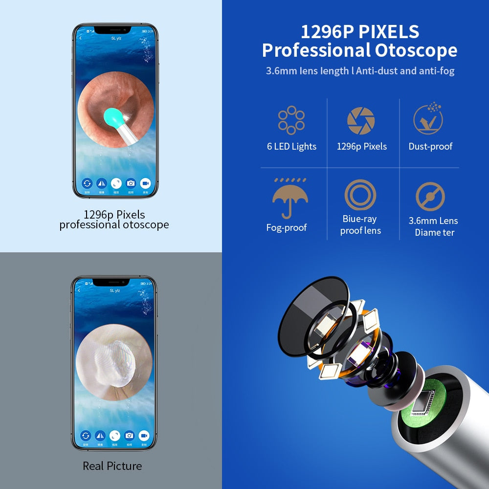 Smart Wireless Camera Otoscope